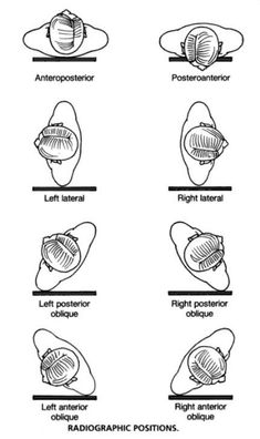 the diagram shows different types of mitts and their functions in each region of the body