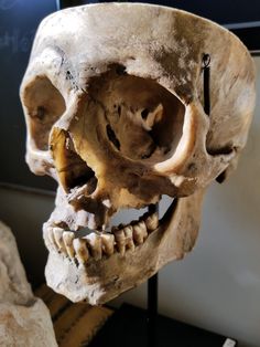 a human skull is on display in a museum