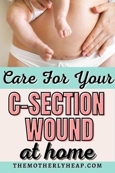 a baby in a diaper with the words care for your c - section wound at home