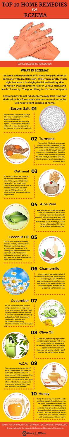 Eczema remedies. How to get rid of eczema using home and natural treatment. Health Coconut Oil, Top 10 Home Remedies, Coconut Oil Uses, Natural Home Remedies, Natural Treatments, Home Remedies, Natural Remedies, Just In Case, How To Use