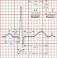 ECG Ekg Placement, Ecg Placement, Ekg Leads, Normal Ecg, Medical Internship, Ekg Rhythms, Ekg Tattoo, Emt Study, Nerdy Nurse