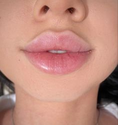 Ideal Lips, Pillow Lips, Facial Contouring, Lip Augmentation, Makeup Accesories, Botox Fillers, Lip Injections