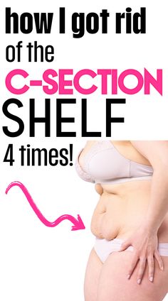 A new mom trying to lose her c-section shelf postpartum tummy with these postpartum workout tips. Shelf Workout, Postpartum Belly Workout, Post C Section, Belly Workouts, Postpartum Tummy