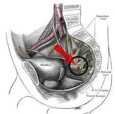 Pudendal Neuralgia and Nerve Pain - Location of Pudendal Nerve Pudendal Nerve, Pelvic Congestion Syndrome, Mental Health Advocacy, Pelvic Floor Dysfunction, Spinal Nerve, Learning Disabilities, Side Wall, Nerve Pain, Pelvic Floor