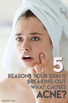 Acne is a skin condition that affects almost everyone at some point in life. It’s important to understand what causes acne to tackle it better. Here are 6 reasons.. your skin might be breaking out. How To Stop Breaking Out On Face, What Causes Acne, Back Pimples, Face Breaking Out, Acne Reasons, Skin Breaking Out, Blind Pimple, Pimples Under The Skin, Bad Acne