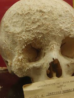 a fake human skull is shown in front of a red wall with writing on it