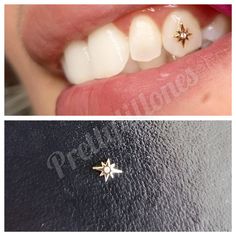 Tooth Jewelry  size are estimate 3mm to 4mm real gold  18kt gold  will not tarnish Gold Tooth Gems Ideas, Tooth Jewelry Diamonds Teeth, Tooth Gems Design, Gold Tooth Gem, Teeth Jewelry Tooth Gems, Tooth Bling, Tooth Gems Aesthetic, Gold Tooth Cap, Teeth Gems