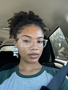 Acne Black Women, Acne Women, Pimple Scars, Mild Acne, Big Nose Beauty, Beauty App