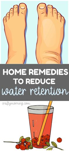 11 home remedies to reduce water retention. Ankles, feet, legs are swollen? Here's how to bring the swelling down! Swelling Remedies, Reduce Water Retention, Water Retention Remedies, Swollen Legs, Body Wrap, Healthy Diet Tips, Water Retention, Daily Health Tips, Good Health Tips