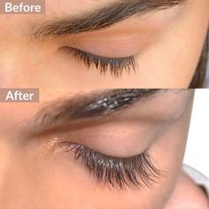 Latisse Eyelashes, Lash Growth Serum, Eyebrow Serum, Lash Growth, Eyebrow Enhancer, Eyelash Growth Serum, Thick Lashes, Eyelash Serum, Lash Serum