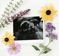 flowers and an x - ray image on a white background with purple and yellow daisies