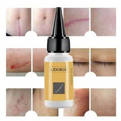 Acne Mark Removal, Delicate Woman, Light Therapy Skin, Face Essence, Face Fillers, Erase Wrinkles, Essence Makeup, Acne Removal, Acne Gel