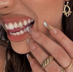 Girls With Grills, Gold Tooth Cap, Girl Grillz, Teeth Aesthetic, Pretty Teeth, Dental Jewelry, Grillz Teeth, Teeth Caps, Diamond Grillz