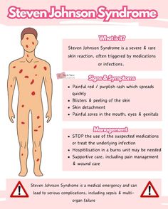 an info sheet describing the different types of syd syndrome