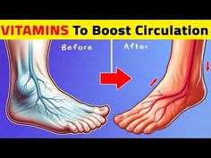 Top 7 Vitamins To Boost Legs and Foot Circulation Instantly! - YouTube How To Increase Leg Circulation, Poor Circulation In Legs Remedies, Revitive Circulation Booster, Exercises For Poor Leg Circulation, Poor Circulation In Feet Signs