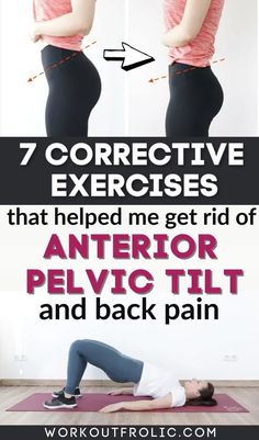 Corrective Exercises, Anterior Pelvic Tilt, Fix Your Posture, Back Stretches For Pain, Pelvic Tilt, Lower Back Pain Exercises, Pelvic Floor Exercises, Nerve Pain Relief, Knee Exercises