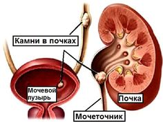 the anatomy of the kidney and its major vessels, labeled in russian language on a white background