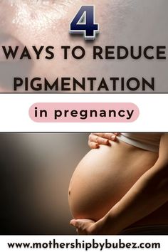 pregnant woman holding her baby bump, text above reads 4 ways to reduce pigmentation in pregnancy Skincare For Pigmentation, Pregnancy Hormones, Physical Sunscreen, Gentle Exfoliator, Broad Spectrum Sunscreen, Skin Issues