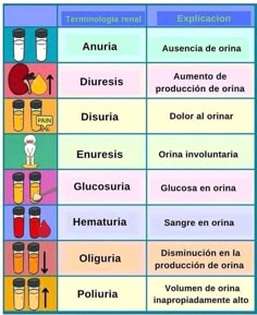 a table with different types of liquids and their names in spanish, english or french