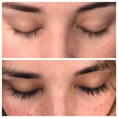 Grande Lash Before And After, Lash Growth Before And After, Eyelashes Before And After, Lashes Growth Fast, Eyelash Serum Before And After, Latisse Before And After, Serum Eyelashes, Grow Longer Eyelashes