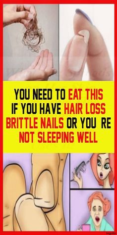 Not Sleeping, Milky Nails, Health Signs, Tongue Health, Brittle Nails, Nail Health, Health And Beauty Tips, Insta Photo, Health Problems