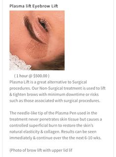 Plasma Facial, Fibroblast Plasma, Plasma Fibroblast, Aesthetic Marketing, Esthetician Quotes, Plasma Pen, Eyebrow Lift, Face Lift Surgery, Botox Alternative