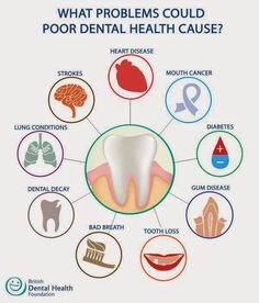 Dental Decay, Kedokteran Gigi, Dental Health Care, Dental Implants Cost, Dental Facts, Dental Bridge