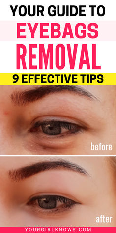 Tired of dealing with stubborn eye bags? This guide offers 9 effective tips, from natural remedies to face massages, for smoother, brighter under-eyes. Save this pin for your go-to eyebags removal tricks! Get Rid Of Eye Bags, Rid Of Eye Bags, Face Massages, Collagen Rich Foods, Hydration Station, Tired Of People, Sleep Eye, Fluid Retention, Wake Up Call