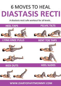 the 6 moves to heal diastasis recti