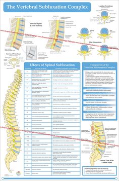 Spinal Subluxation, Medical Worksheets, Spine Illustration, Healthcare Poster, Gut Health Plexus, Health 2023, Lumbar Vertebrae, Spinal Degeneration