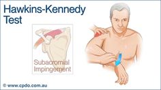 hawkins test - Google zoeken Np School, Radial Nerve, Shoulder Dislocation, Ulnar Nerve, Medical Pictures, Musculoskeletal System, Rotator Cuff, Nurse Practitioner, Shoulder Pain