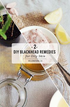 Keep your t-zone all clear with these DIY blackheads oily skin remedies (a cleanser and a mask) made from all-natural ingredients. Face Cleanser Diy, Remedies For Oily Skin, Oily Skin Remedy, Blackhead Remedies, Routine Checklist, Cold Sores Remedies, Baking Soda Shampoo, Natural Cold Remedies, Get Rid Of Blackheads