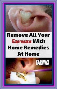 | Clean Ear Wax Out, Ear Cleaning Wax, Wellness Selfcare, Ear Drops, Ear Wax Removal, Ear Health, Ear Cleaning, Medical Terms, Ear Wax