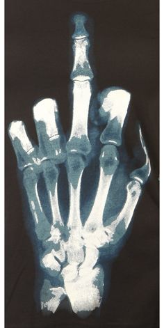 an x - ray image of a skeleton hand