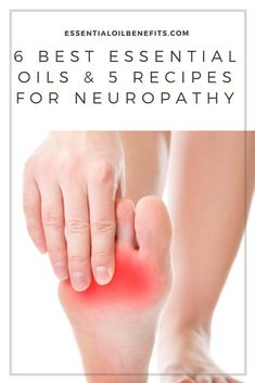 Nerve Pain Remedies, Essential Oils For Pain, Nerve Pain Relief, Essential Oil Blends Recipes, Essential Oil Benefits, Healing Oils, Young Living Oils