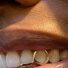 Pearl Set Studio - Grillz on Instagram: "Beautiful gold window and bar ✨   #goldgrillz #customgrillz #grillz #diamondgrillz  #silvergrillz #teethjewelry #grillzlondon #londongrillz #toothgems  #icedout #blingbling #handmadejewelry" Girl Grillz Gold Grill, Minimal Grills Teeth, Gold Grills Women, Tooth Window Grill, 2 Piece Grillz, Partial Teeth Grills, Window Grillz Teeth, Simple Grills Teeth, Single Grillz Teeth