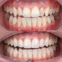 Dental Morphology, Clinic Social Media Design, Dental Clinic Social Media, Clinic Social Media, Dental Technician, Raw Meat