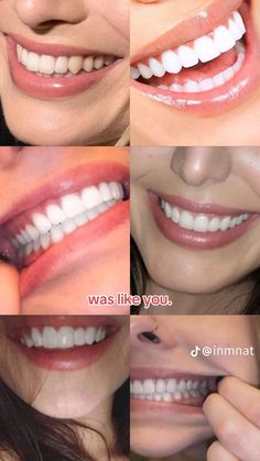 Perfect Teeth Vision Board, Perfect Teeth Subliminal, Pretty Teeth Smile Aesthetic, Teeth Aesthetic Smile, Aesthetic Teeth Smile, Celebrity Surgery, Pretty Nose, Beautiful Teeth, Smile Teeth