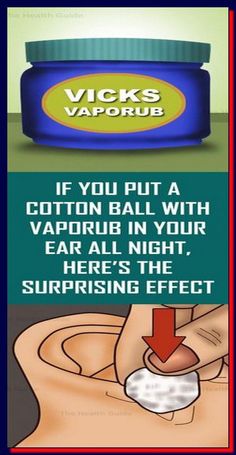 If You Put A Cotton Ball With  - VapoRub in Your Ear All Night, Here’s The Surprising Effect! by inepvacea inepvacea | This newsletter was created with Smore, an online tool for creating beautiful newsletters for educators, businesses and more Vicks Remedies, Sinus Headache, Health Guide, Cotton Ball