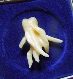 Dentist's nightmare Teeth Pictures, Dental Facts, Soft Foods, Dental Art, Dental Humor, Surgery Recovery, Dental Surgery, Wisdom Teeth, A Frog