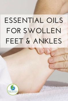 Swollen Feet Remedies, Essential Oil For Swelling, Feet Remedies, Water Retention Remedies, Varicose Vein Remedy, Swollen Ankles, Summer Mantle, Swollen Legs