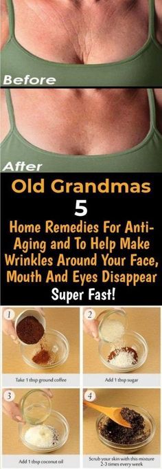 Old Grandmas 5 Home Remedies für Anti-Aging und helfen, Falten um Gesicht, Mund... ,  #AntiAging #falten #für #Gesicht #Grandmas #helfen #Home #Mund #Remedies #und Check more at https://hautpflege.naa7.com/old-grandmas-5-home-remedies-fur-anti-aging-und-helfen-falten-um-gesicht-mund/ Coconut Oil Scrub, Mouth And Eyes, Forehead Wrinkles, Beauty Remedies, Food Blogs, Anti Aging Skin Products, Aging Skin Care, Pavlova, Anti Aging Skin Care