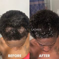 Haters will say it’s not the same person but they have the same tattoo… . . . #hairgrowthtips #hairgrowthoil #hairgoals #scalpstimulator #hairloss #hairlossremedies #naturalhairproducts #naturalhair #hairgrowthproducts #dryscalp #hairgrowthproduct #besthairgrowthoil #quickhairgrowth #hairgrowthjourney #hairgrowthremedies Hair Growth Tips, Hair Growth Oil, Health Supplements, Hair Goals