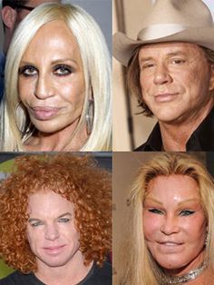 Botched Plastic Surgery, Bad Plastic Surgeries, Celebrities Before And After