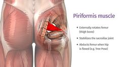 Psoas Muscle Pain, Tight Hip Flexors