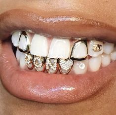 Dental Jewelry