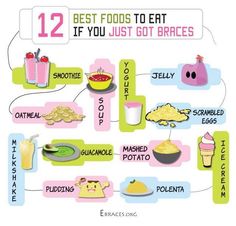 If your new to wearing braces, you may be wondering "what can I eat?" Here is a chart of some soft foods that are great to eat when you first get braces. Braces Must Haves, Soft Foods To Eat With Braces, Best Foods To Eat With Braces, Foods To Eat With Braces Soft, Foods You Can Eat With Braces, Things To Eat When You Have Braces, Things You Can Eat With Braces, Foods To Eat When You Get Braces, Braces Food Ideas