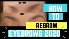 If you're like me and are having issues with eyebrow regrowth, let me show you what I used to grow my eyebrows back fast! In this review of revitabrow I show... Sciatic Nerve Pain, Sensitive Teeth, Nerve Pain, How To Grow, Belly Fat, All Natural, To Grow