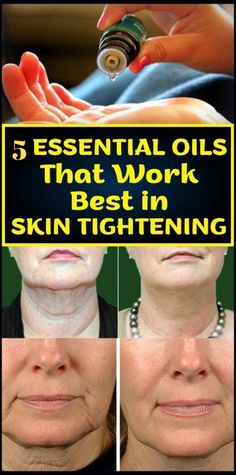 Essential Oils For Skin, Beauty Natural, Best Essential Oils, Loose Skin, Wrinkle Remover, Anti Aging Skin Products, Oils For Skin, Skin Tightening, Skin Conditions