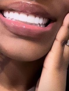 Smile Teeth, Perfect Smile, Teeth Whitening Kit, Teeth Care, Pretty Smile